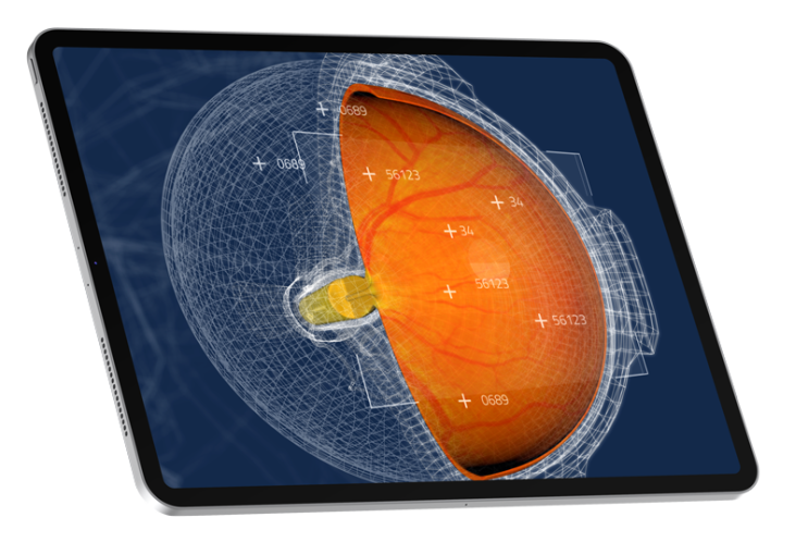 Visual representation of Toku Eyes' AI platform analysing retinal images